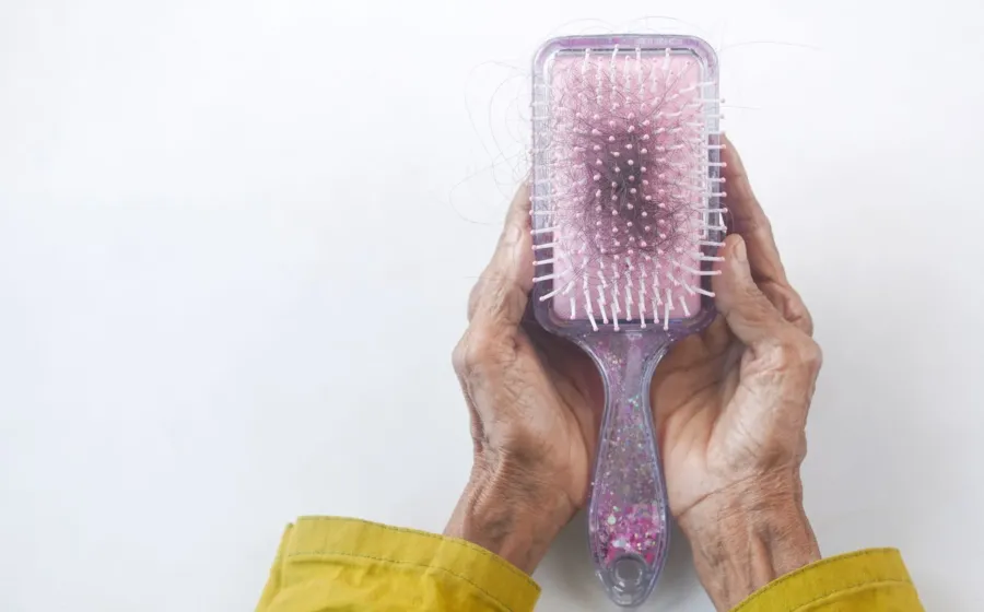 Ilustrasi cara mengatasi rambut rontok dengan perawatan rambut alami menggunakan minyak kemiri dan kelapa